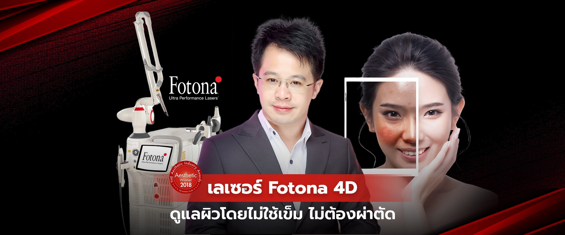 fotona4D-v2